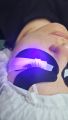 Led- наращивание рекомендуется девушкам у которых есть аллергия на обычный клей. Так же отлично носят такие ресницы девушки с очень гладкими, (стекловидными ресницами). Носкость таких ресниц увеличивается до +2 недели к обычному сроку носки клиенток.