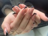 Укрепление жестким гелем