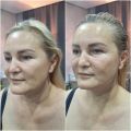 Результат первого сеанса