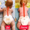 Малышу 6,5 месяцев. Не поворачивался на живот, привычный поворот головы, загиб