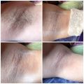 Депиляция инновационным полимерным воском Skin,s