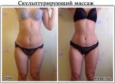Скульптурирующий массаж, курс 8 сеансов