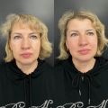 Массаж лица Ахабадзе, лимфодренажный