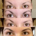 Восстановление и отращивание бровей. 