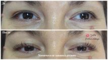 Процедура химической завивки ресниц