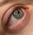 Зажившая межресничка после первичной процедуры 