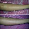 Электроэпиляция голени
Время: 140 мин