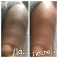 10 процедур антицеллюлитного массажа без обёртываний 