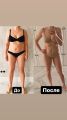 Результат после курса из 15 процедур гидромассажа!