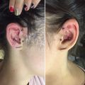 Trago piercing, forward helix, conch