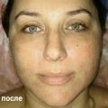 После 7 сеансов