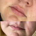 Эффект увлажнение,на фото зажившие губы