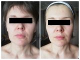 До и после массажа лица