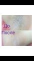 Шугаринг подмышечных впадин