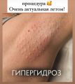 Лечение гипергидроза. Процедура действует от 3х месяцев до 1 года и избавляет вас от потливости в подмышках. Вы навсегда забудете о неприятной потливости подмышек