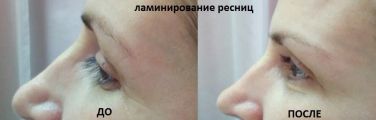 Ламинирование ресниц