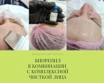 Чистка лица+пилинг Biorepeelcl3