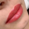 Губы после процедуры