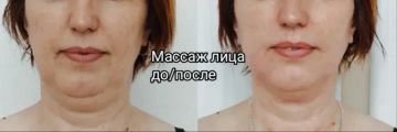 Массаж лица лимфодренажный. 