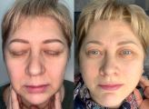 Слева зажившие брови после 1 процедуры перекрытия старого татуажа