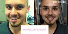 Коррекция бровей мужчине)

