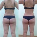 Хотите скорректировать фигуру - вам к нам, ты знаем как это сделать!