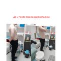 Результаты криолиполиза до и после 