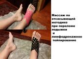 Лечебный массаж при переломе лодыжки и лимфодренажное тейпирование.