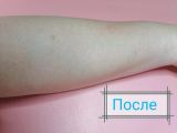 После эпиляции сахаром 