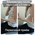 Мальчик, 11 лет. Закрытый перелом нижней трети плечевой кости, оперативное вмешательство, гипс на 3 недели. Должная реабилитация не проводилась. 

Спустя пол года после перелома обратились в связи с ограничением движения в локтевом суставе, ноющими болями в непогоду в плече и локте.

Проведён 1 сеанс массажа. В результате работы увеличился объем движения в суставе. Даны рекомендации на дом.