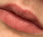 Зажившие губы после первой процедуры (фото без фильтров)