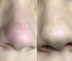 Чистка ручная мельчимую 13 лет