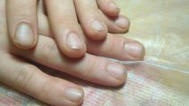 Фото до мужского маникюра, фото 1 . (Мужской маникюр) 