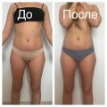 Лимфодренажный антицеллюлитный массаж - 6 сеансов