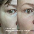 Массаж лица! 