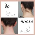 Удаление нежелательных волос в области шеи