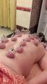 Лечебный массаж + банки, глубоко разогревает мышцы спины, расслабляет, снимает наприжение и боль.