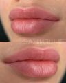 Заживший перманентный макияж губ