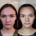 Работа с лицом и процедура FlaxLIFT 
стоимость 1500руб