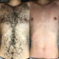 Грудь и живот сахарной пастой 