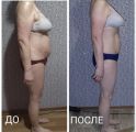 На фото показан массажный кабинет и некоторое фото результата после массажа. 