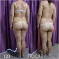 За 50 дней вес уменьшился на 6 кг. Объём рук  уменьшился на 1,5 см, объём талии уменьшился на 5,5 см, объём каждого из бёдер уменьшился на 4 см. Был проведён курс по коррекции фигуры (2 лимфодренажа, 10 антицеллюлитных массажа, 2 обёртывания), 10 домашних самостоятельных обёртываний, интенсивные физические нагрузки и сбалансированное питание