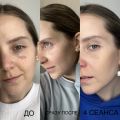 - Комбинированная чистка лица
- Мезотерапия лица, глаз
- Массаж лица классика/ лимфодренаж
- Профессиональный уход