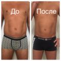 На фото результат курса липолитического/лимфодренажного массажа.