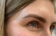 Зажившие брови