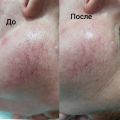 до и после